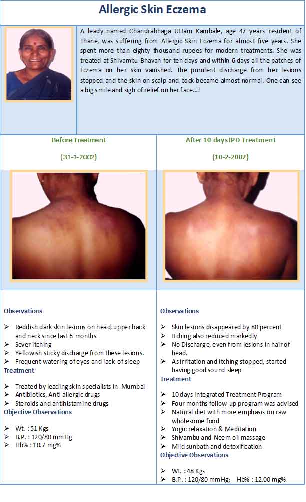 allergic skin