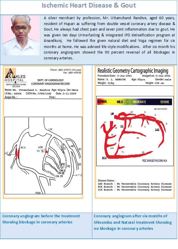 ischemic