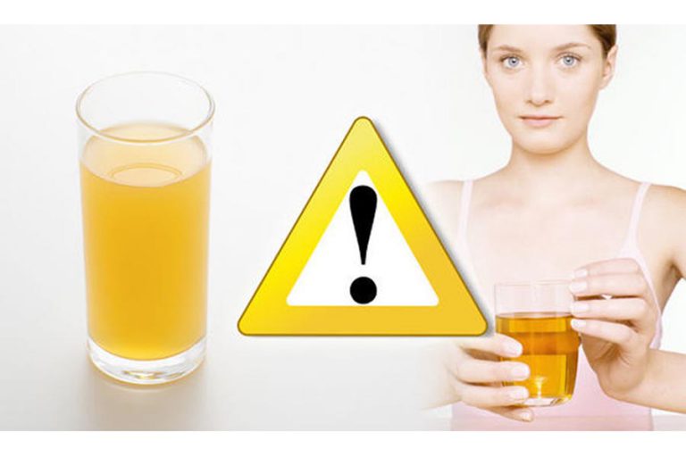 FAQs on Urine Therapy
